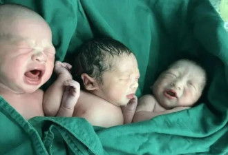 孕妇剖腹产龙凤胎 缝合一半 喊 还有东西在动