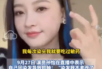 孙怡直播自曝因染发导致脸肿：我每次染头都要吃过敏药