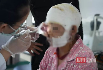孕妇遭熊袭击装死保命：熊牙刺入右眼左耳 头部撕裂