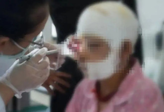 被熊袭击能装死吗？秋季“熊出没”如何避险