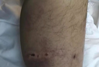 被熊袭击能装死吗？秋季“熊出没”如何避险