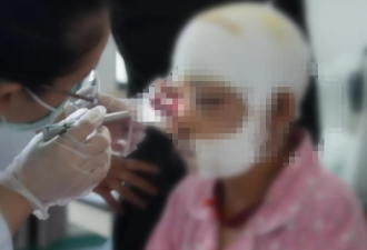 22岁孕妇遭黑熊袭击 眼球掉出来 靠这招捡回一命