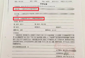 女子"左侧输尿管手术被做在了右侧",卫健部门回应