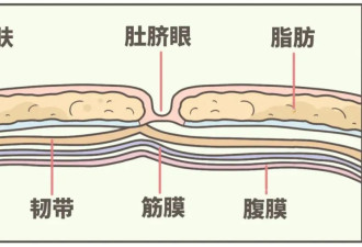 肚脐眼里的泥到底能不能抠啊？