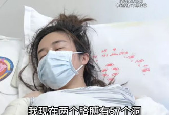 女子减肥打100多针后身上溃烂 清创被挖50多个洞