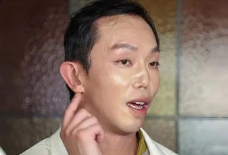 香港知名太子爷遇严重车祸,毁容面部重建,至今...