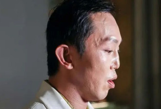 香港知名太子爷遇严重车祸,毁容面部重建,至今...