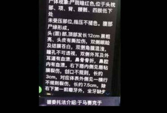 于朦胧遭虐杀传新证 尸检报告揭惨烈细节