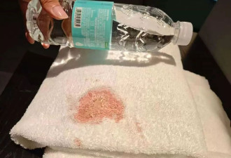 男子在酒店使用浴巾发现大片血迹，担心染病要求赔偿