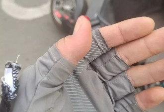 纪录：一个外卖骑手耗时661天的工伤维权