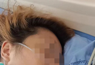 徒步党岭高反 女孩今年刚毕业 可能成植物人