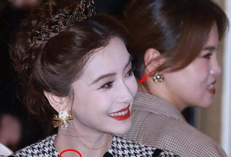Angelababy出席活动，生图假白法令纹重