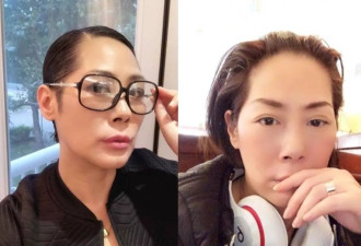 同是50+女星:叶倩文有活力，为何关淑怡却全身插管