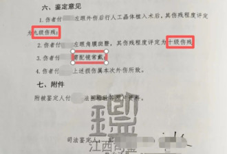 5岁男童在幼儿园被戳瞎 监控“自觉”坏了