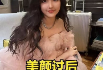 周迅近照曝光!头发发白,瘦到皮包骨,终究为恶习付出了代价