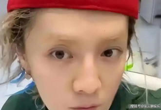 继赵露思鹿晗生病后，白鹿又自曝病情，无力绝望，什么也吃不下