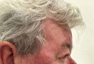 老头半张脸都是鼻子 嘴都看不见 割完终于爽了