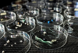 科学家发现：我们脑子里已都是微塑料了