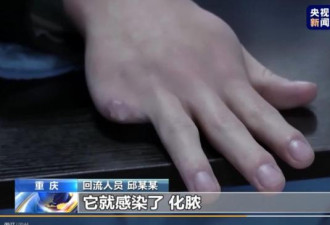 中国抓获徐老发 不服从管理者遭剁手指