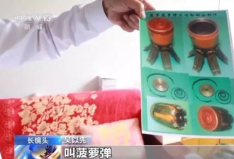 "老先生，您把项链取下来再做CT""你看是不是弹片"