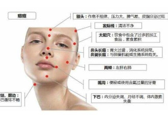 长痘痘的位置图解 长痘暗示身体出现了问题