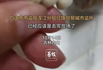 吉林香肠、东莞烧卖…接连有人吃到“人类牙齿”