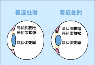 一种对眼睛巨巨巨好的运动，建议大家多做！！