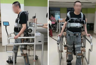 全球首例！中国医生让四肢瘫痪者自主行走