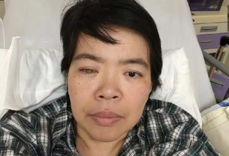 突发！香港女星脚部溃烂导致细菌感染，面临截肢风险崩溃大哭