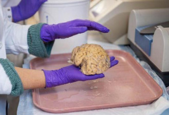 超级老人：80岁拥有50岁的大脑 科学家如何解释