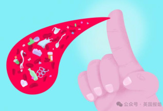 “换血”富翁又整活：这方法成功排出微塑料