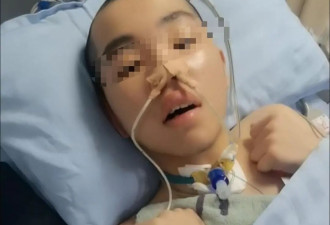 14岁男生嬉闹时被女同学打中左胸后瘫痪 女孩父母为残疾人 费用无着落