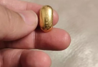 熊孩子误吞10克重金豆 妈妈：叮嘱他别在外面拉屎