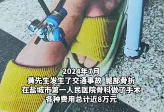 患者术后自查耗材价格，医院比网上贵十几倍