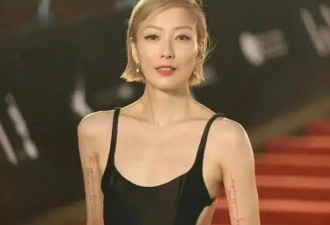 郑秀文自曝坐轮椅！出轨婚变6年后，郑秀文把自己折磨得骨瘦如柴