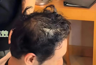 黄晓明头发稀疏显秃顶 脸上有斑褶子多 手控制不住发抖