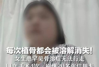 女孩15岁时摔伤手术后大腿骨头“消失”：每次植骨后都会溶解