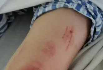 “女子驾车逃跑致丈夫身亡案”二审开庭未宣判