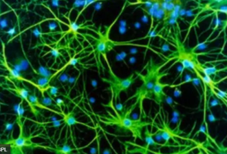 科学家首次记录临终记忆闪回脑波