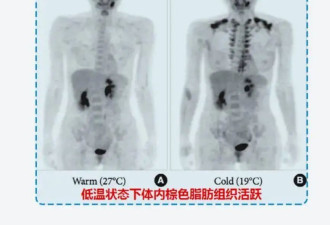 怕冷的人VS抗冻的人 哪个更健康？