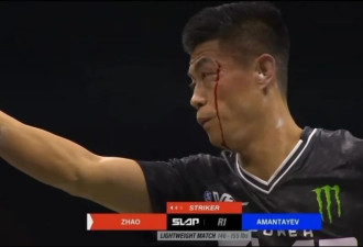 扇耳光大赛赵鸿刚：练了两年通背拳 没想到打成这样