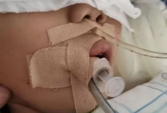 9岁女童术后成了植物人，医院多科室医护人员篡改病历