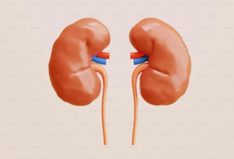 全球十大死因公布！这疾病首进榜