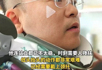 蔡磊现状令人泪目 舌头嘴唇已经萎缩 洗澡用绳子吊