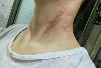 从家暴到割喉，女护士5年的“漫长死亡”