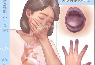 这种菜冬天千万别吃多，真的会得癌