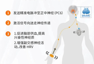 职场人靠手环“电击续命”，有人已被烧伤