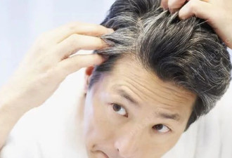 白发也许是身体避免致命癌症的代价