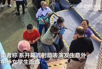 运动会一箭射穿女生脸 校方：没射穿嘴唇