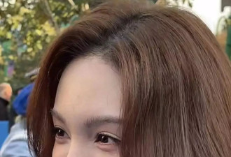 金晨怼脸拍鼻翼疤痕明显，妆浓到卡粉都遮不住